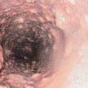 給水管の中はこんなに汚れています